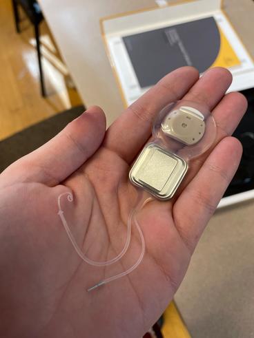 a cochlear implant sitting in the palm of a hand illustrating how small it is